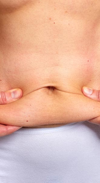 HR Plastic Sugery - Excess - loose abdominal skin