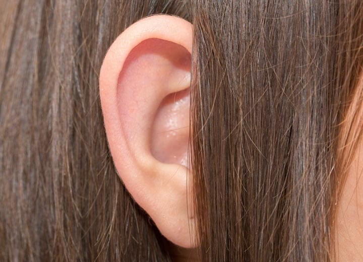 HR Plastic Sugery - Large ears - sticky out ears - Bat ears