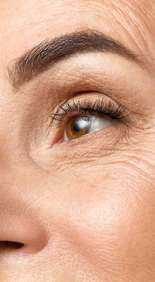HR Plastic Sugery - Skin wrinkles