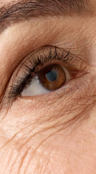 HR Plastic Sugery - Skin wrinkles