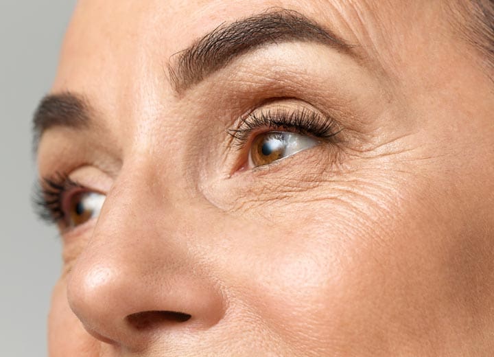 HR Plastic Sugery - Skin wrinkles