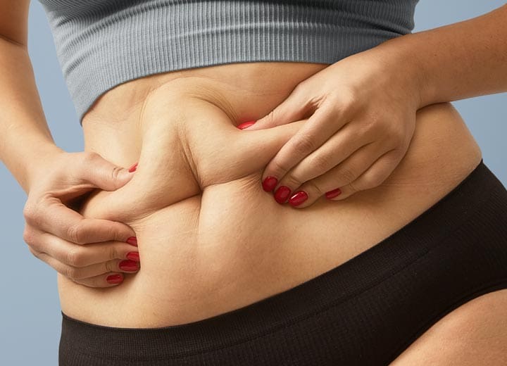 HR Plastic Sugery - Tummy pouch