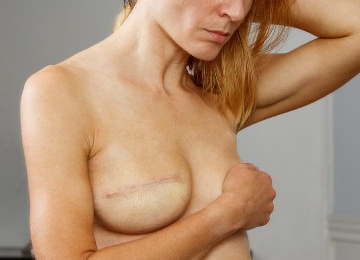 HR Plastic Surgery - Breast Reconstruction vid