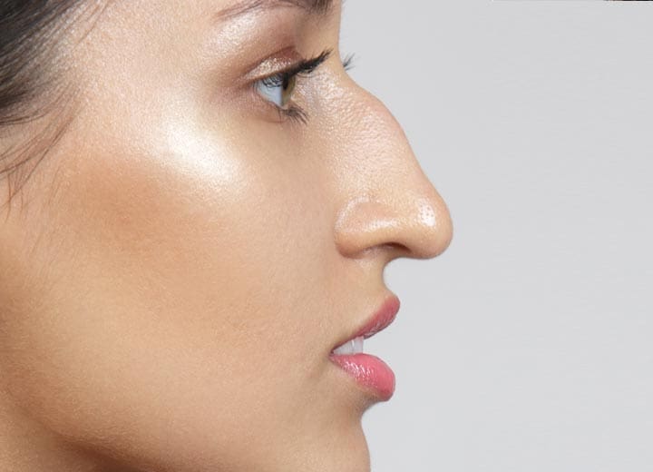 HR Plastic Surgery - Misshapen Nose