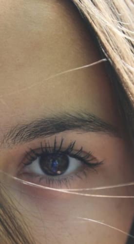 HR Plastic Surgery - Brow Lift Surgery The Process