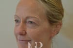 HR Plastic Surgery - Facelift patient before 3