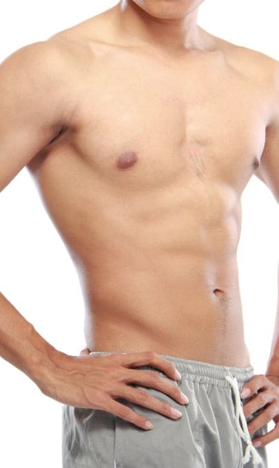 HR Plastic Surgery - Flank Liposuction Prep For Surgery
