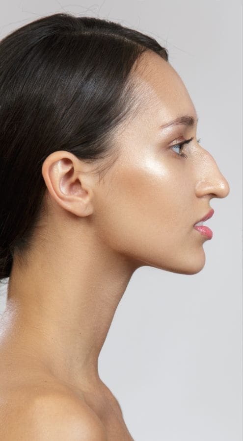 HR Plastic Surgery - Misshapen nose
