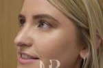 HR Plastic Surgery - Nose Reshaping (Rhinoplasty) patient after 12
