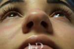 HR Plastic Surgery - Nose Reshaping (Rhinoplasty) patient before 10