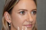 HR Plastic Surgery - Nose Reshaping (Rhinoplasty) patient before 15