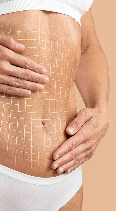 How Much Does Tummy Tuck Cost