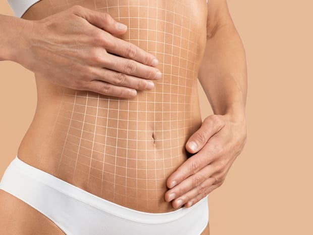 How Much Does Tummy Tuck Cost