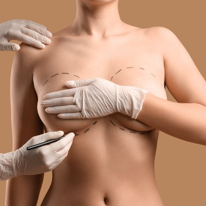 HR Plastic Surgery - Achieving asymmetry