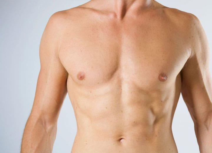 HR Plastic Surgey - Male Breast Reduction (Gynaecomastia) Patient Gallery